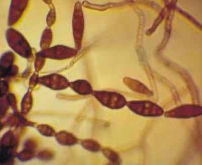 Alternaria mycelial fragments.