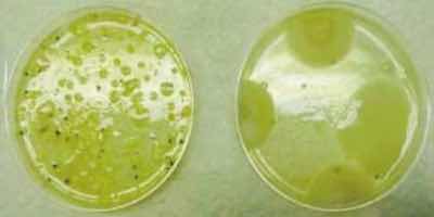 Acid-etch rinse cultures.