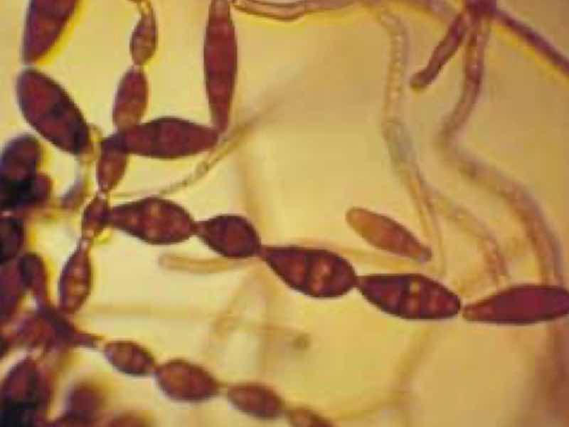 Alternaria mycelial fragments