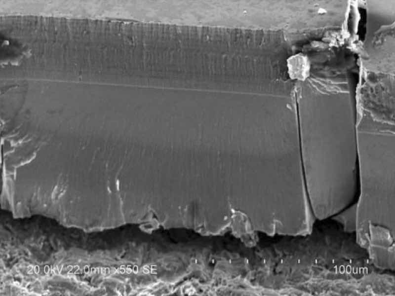 microscopic image of tri