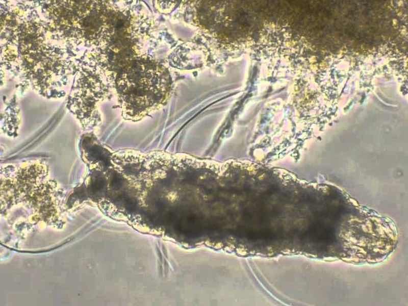 Tardigrades, often called water bears or moss piglets, are near-microscopic animals with long, plump bodies and scrunched-up heads. 