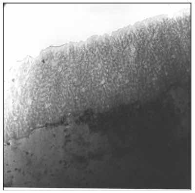 Figure 5: TEM image of a Type I or chromic acid anodic oxide. AAO produced in chromic acid doesnât show a columnar structure, but it is spongy and porous. The random structure prohibits finish growth beyond 3 to 5 microns.