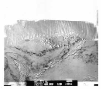 Figure 3: X15,000 Documentary TEM photomicrograph of an anodized aluminum substrate. Note the presence of circular inclusions (iron-chromium) which had been taken up into the Type III columnar structure during anodization. Atomic level defects in the aluminum substrate are seen to affect the finish structure at the finish-substrate interface.