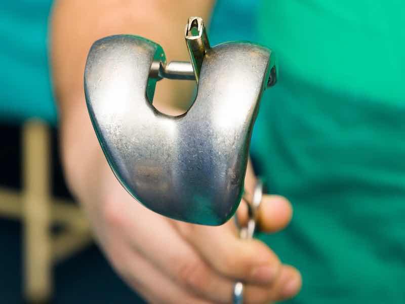 knee implant