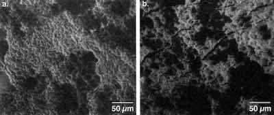 Figure 7 - Response of surfaces to stretch draw forming: (a) basal plane parallel, (b) basal plane near perpendicular (SEM: 1000Ã).