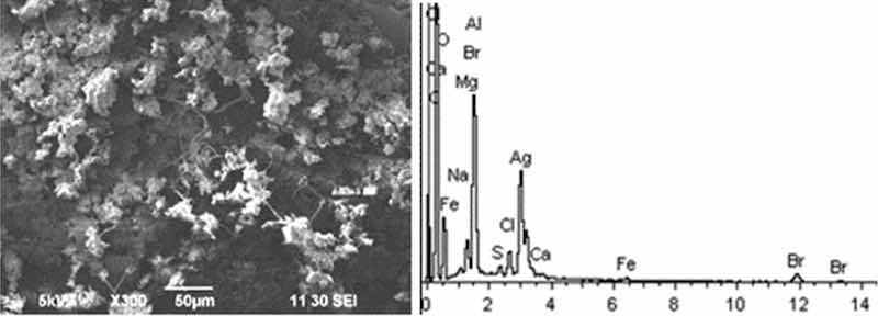 Fig 5: Aluminum etching. Particles morphology. Scanning electronic microscopy. MagnificationâÃ300.